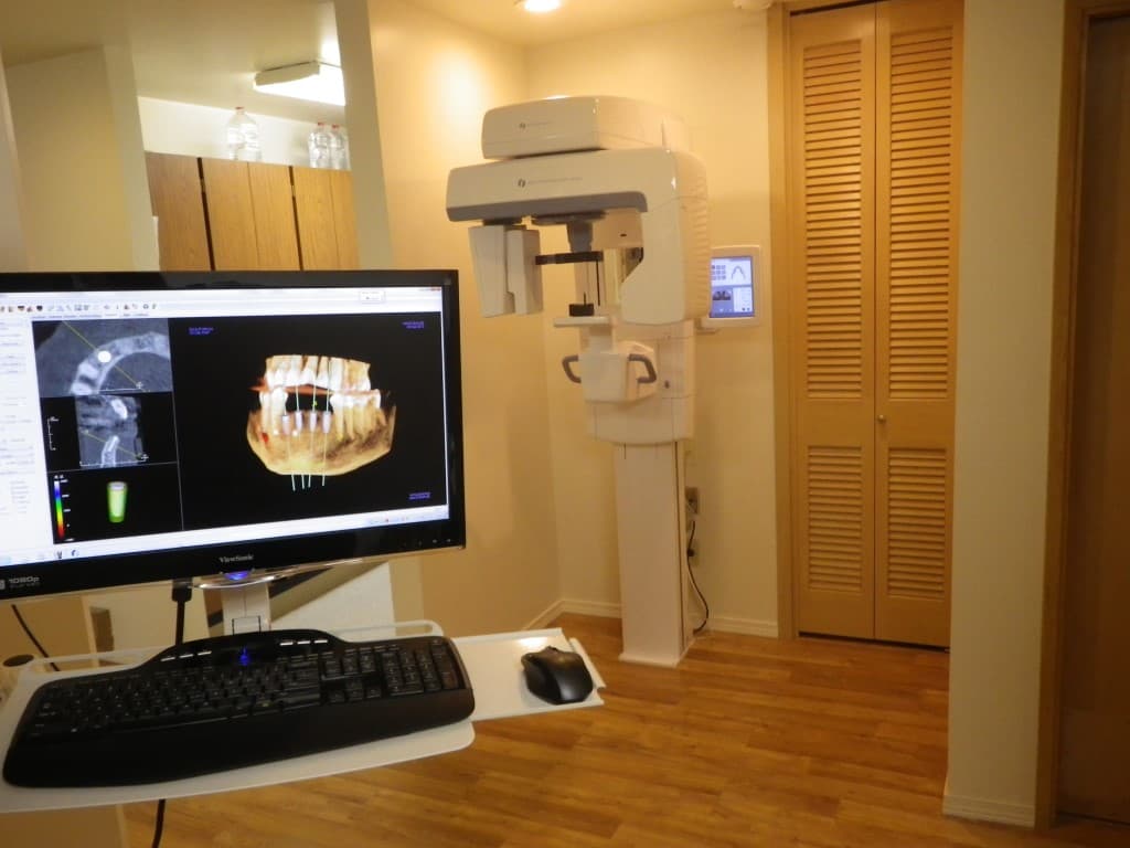 Dental imaging room with a CBCT scanner and a three-dimensional jaw scan on screen